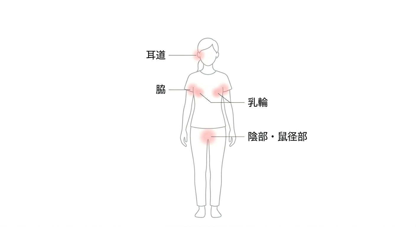 アポクリン汗腺の分布図（脇・陰部・鼠径部・乳輪・耳道）